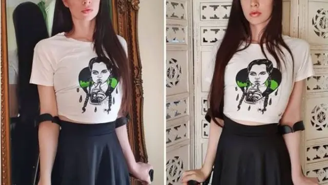 Cerita Model yang Kakinya Diamputasi, Fotonya Sempat Disangka Hasil Editan