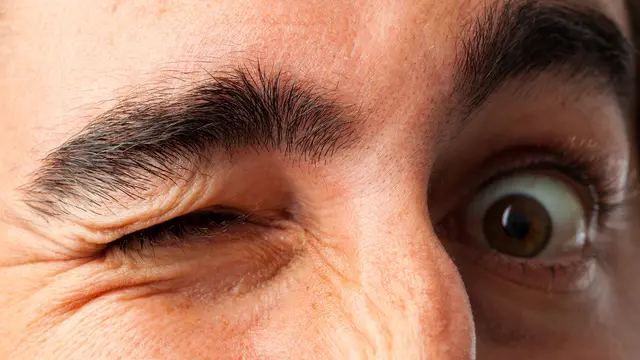 Kenali 8 Penyebab Mata Kedutan (Kues/Shutterstock)