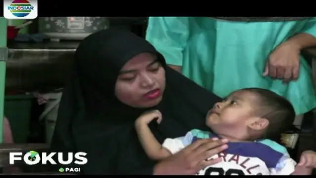 Selain Asmat, Gizi Buruk Juga Terjadi di Tanjung Priok