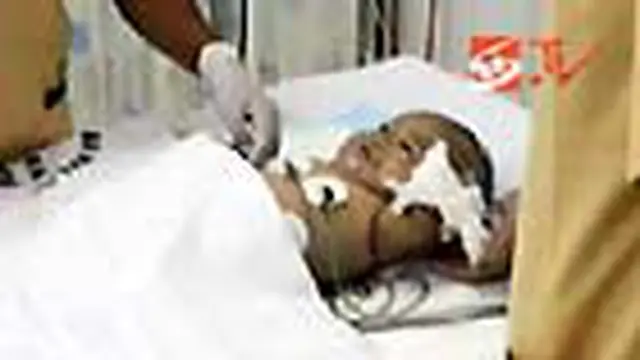 Raffa, bayi korban penganiayaan di Medan, Sumut, kehilangan lengan kiri akibat sabetan senjata tajam dan luka bakar di sekujur tubuh. Ia berada dalam kondisi kritis.