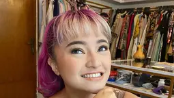 Sebelumnya, perubahan fisiknya yang kian berisi merupakan salah satu dampak dari pengobatan yang sempat dijalaninya. (instagram.com/marshanda99)