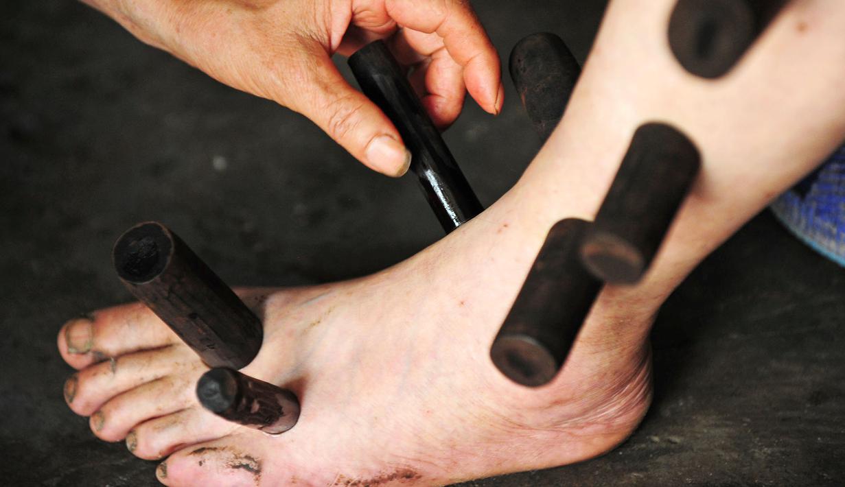 Kaki seorang pasien sedang mendapat terapi bekam di sebuah klinik di Pujiang County, Chengdu, Tiongkok (10/8). Konon, terapi bekam ini telah ada di Tiongkok sejak ribuan tahun silam. (REUTERS)