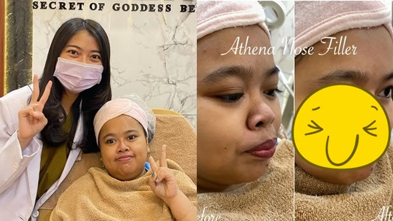 6 Potret Terbaru Kekeyi Setelah Filler Hidung, Tampil Beda