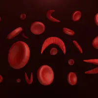 Mengenal Anemia Sel Sabit Lebih Dekat (extender_01/Shutterstock)