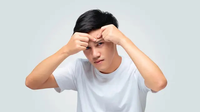 Jerawat di Dahi Pria, Ternyata Ini Penyebab dan Cara Mengatasinya