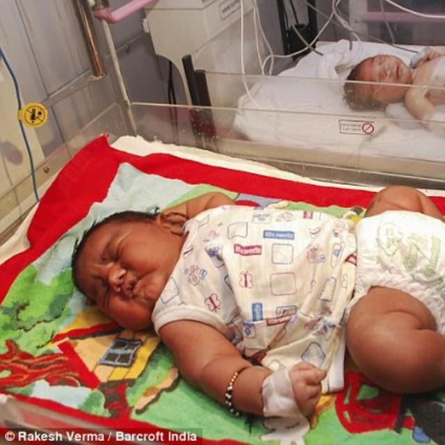 6 Bayi Raksasa Dari Penjuru Dunia Global Liputan6 
