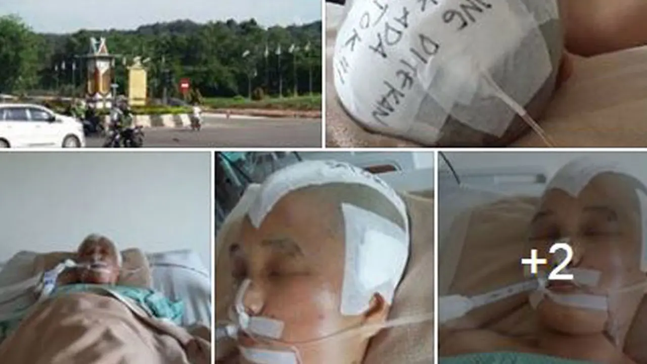 Wanita Pecah Tempurung Kepala Diduga Korban Tabrak Lari Polisi