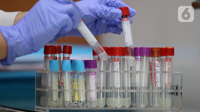 Peneliti mengambil sampel di Laboratorium Pusat Prodia di Jakarta, Rabu (3/6/2020). Prodia Wellness Genomics mampu mendeteksi risiko 39  jenis penyakit pada wanita dan 36 penyakit pada pria sekaligus. (Liputan6.com/HO/Deny)