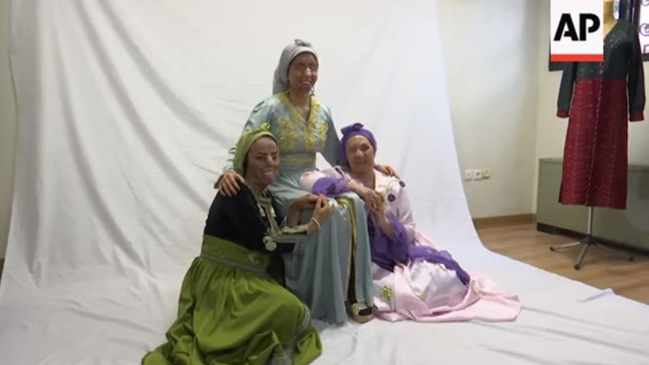 Penyintas Serangan Air Keras