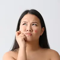 ilustrasi skin fasting/unsplash