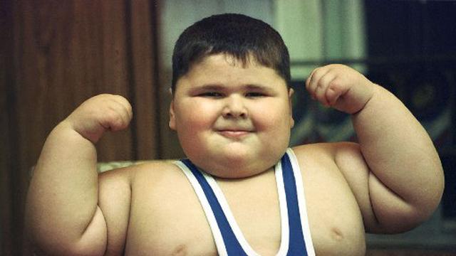 Remaja Yang Anggap Dirinya Gemuk Bakal Obesitas Health Liputan6 Com