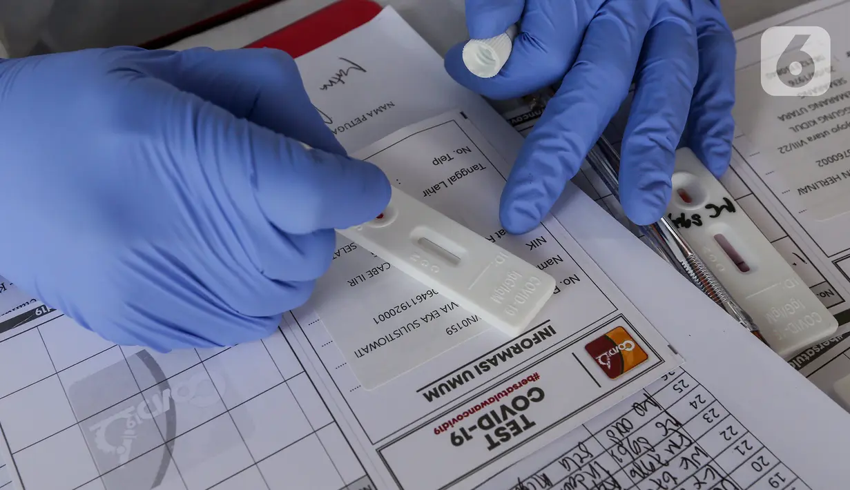 Tenaga medis melihat hasil rapid test massal yang digelar Badan Intelijen Negara (BIN) di lapangan Kecamatan Pamulang, Tangsel, Kamis (2/7/2020). Dengan adanya rapid test yang digelar BIN, Pemkot Tangsel dapat melakukan tracking dan tracing lebih cepat. (Liputan6.com/Fery Pradolo)