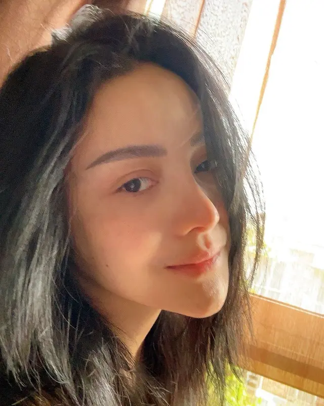 6 Potret terbaru Mawar AFI usai operasi plastik habiskan Rp521 Juta 