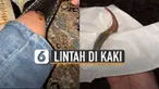 Perempuan itu menemukan lintah yang sudah menghisap darahnya di dalam kaos kaki.