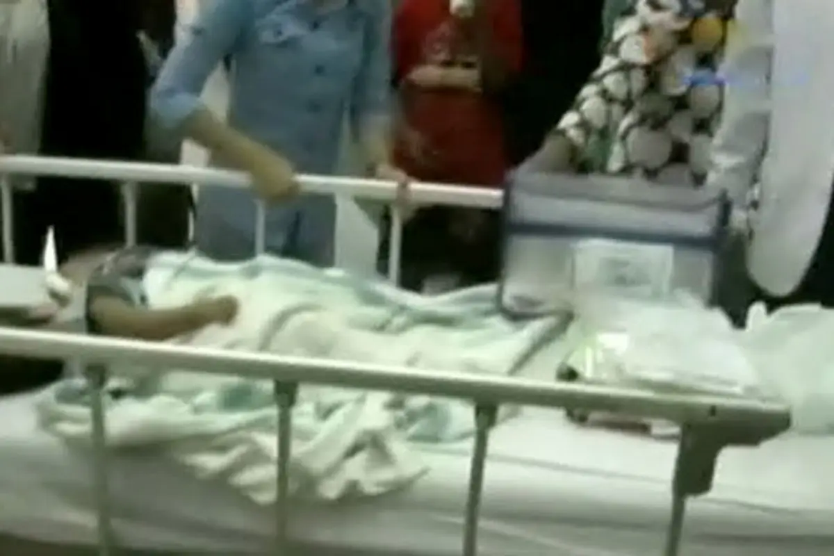 Bayi Kembar Siam Akan di Operasi