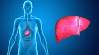 Banyak Murid Terindikasi Infeksi Hepatitis A, Satu Sekolah Diliburkan