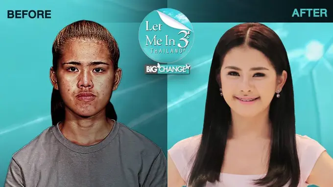 [Bintang] Operasi plastik