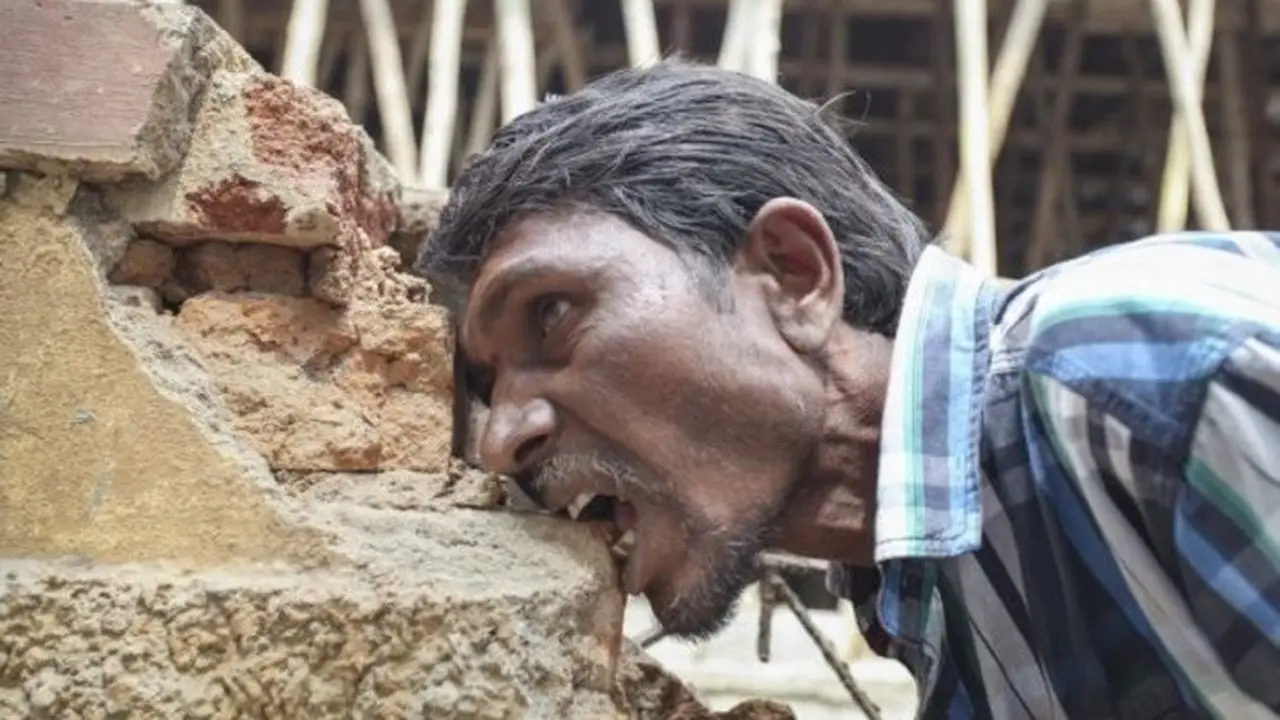 Selama 20 Tahun, Pria Ini Kecanduan Makan Batu Bata dan Lumpur