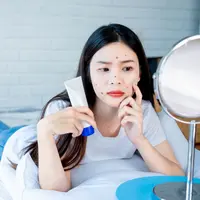 ilustrasi Kenali kandungan spot treatment yang ampuh mengatasi jerawat/BR Photo Addicted/shutterstock