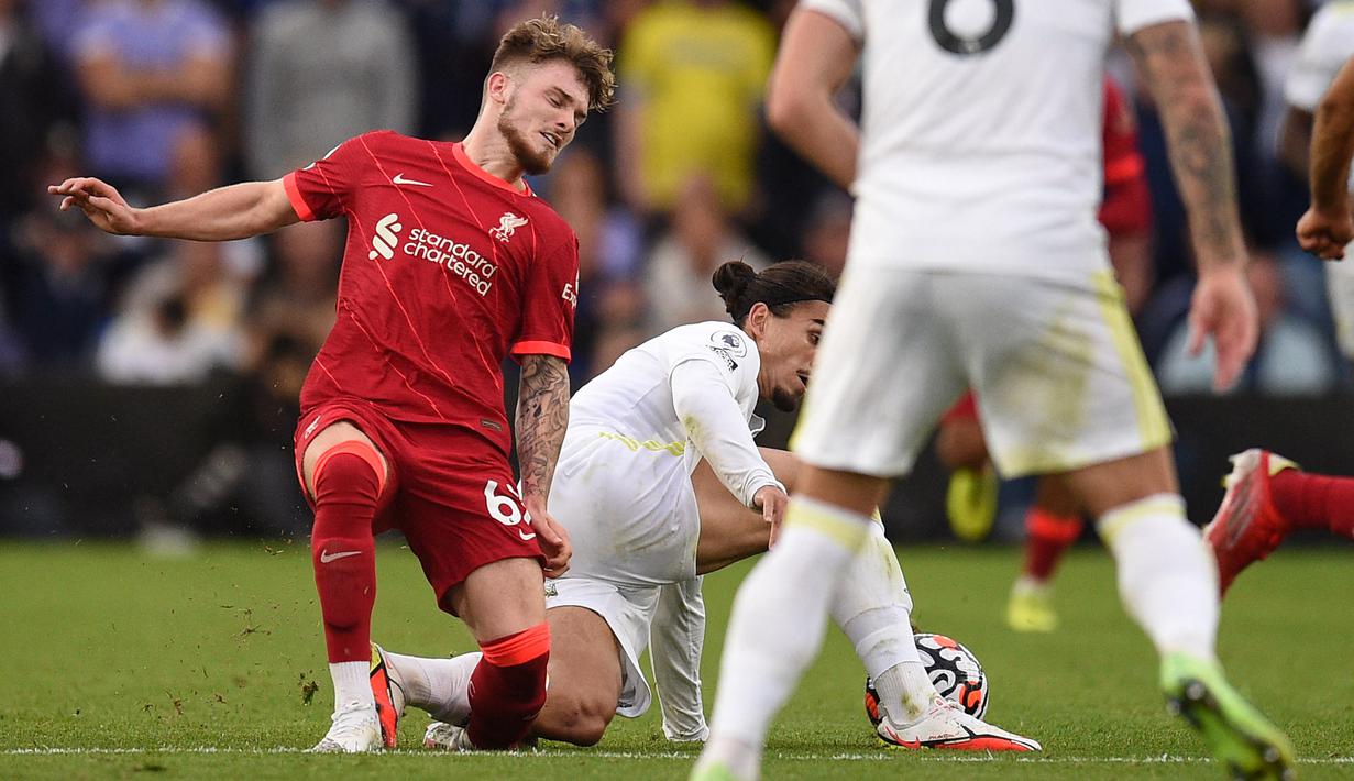 Bintang muda Liverpool, Harvey Elliott, mengalami cedera parah saat timnya bersua Leeds United pada laga pekan keempat Premier League, Minggu (12/09/2021). (Foto:AFP/Oli Scarff)