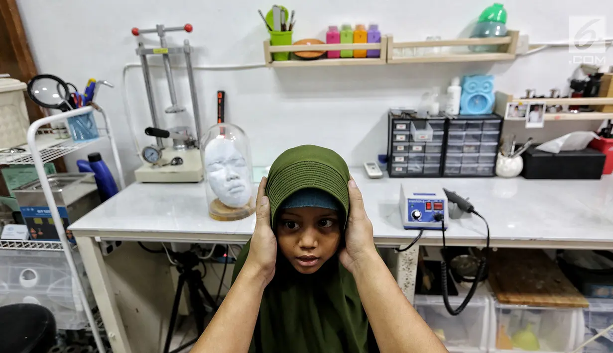 Seorang pasien anak usai dipasang bola mata palsu anak di Klinik Ilyarsi Okularis, Villa Bintaro Indah, Tangsel, Selasa (15/5). Sebanyak 23 mata palsu dibagikan secara gratis pada Gerakan 1.000 Mata Palsu Gratis. (Liputan6.com/Fery Pradolo)
