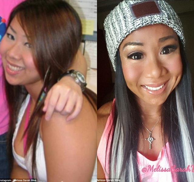 Perbedaan Melissa saat masih gemuk dan setelah menjadi langsing | Photo: Copyright asiantown.net