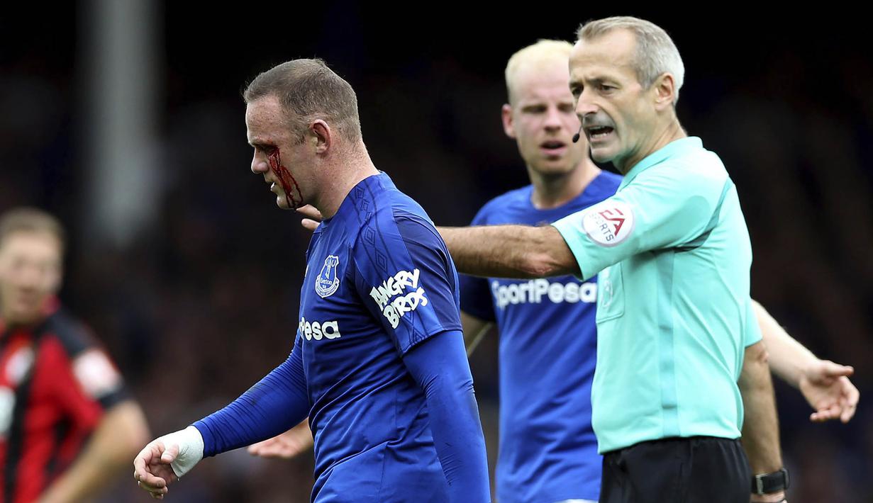 Striker Everton, Wayne Rooney, meninggalkan lapangan usai mengalami pendarahan di mata kirinya pada Premier League, di Stadion Goodison Park, Sabtu (23/9/2017). Everton menang 2-1 atas Bournemouth. (AP/Barrington Coombs)