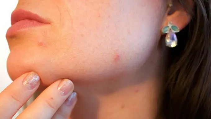 Copyright: pixabay.com/Kjerstin_Michaela