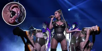 Seorang public figure terkadang harus terlihat baik-baik saja di depan umum meski sebenarnya menyakitkan. Seperti halnya Beyonce di atas panggung, meski darah sudah bercucuran ia tetap melanjutkan penampilannya. (doc.People.com)