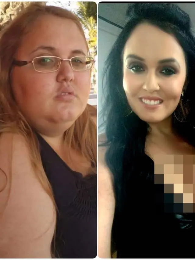 [Bintang] Operasi Berat Badan