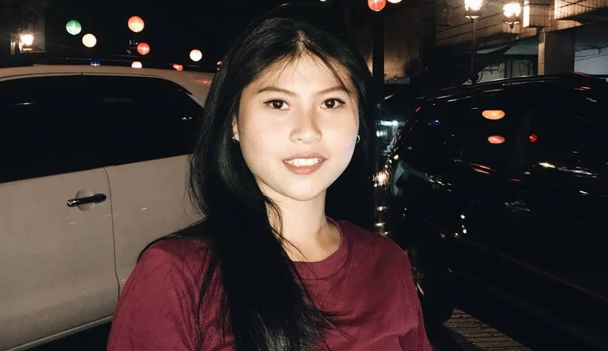 Disebut manis karena punya gigi gingsul, tak sedikit yang menyayangkan Mitzi Abigail harus pakai behel untuk menghilangkan gigi gingsulnya. Pernah jadi atlet bulutangkis, tak sedikit orang khususnya para pecinta bulutangkis yang mengenal wanita dengan nama lengkap Mitzi Abigail Purnama ini, apalagi setelah diketahui bahwa Mitzi menjalin hubungan dengan Anthony Ginting. (Liputan6.com/IG/@mitziabigail)