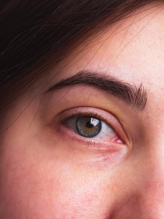 Ilustrasi kedutan alis kanan