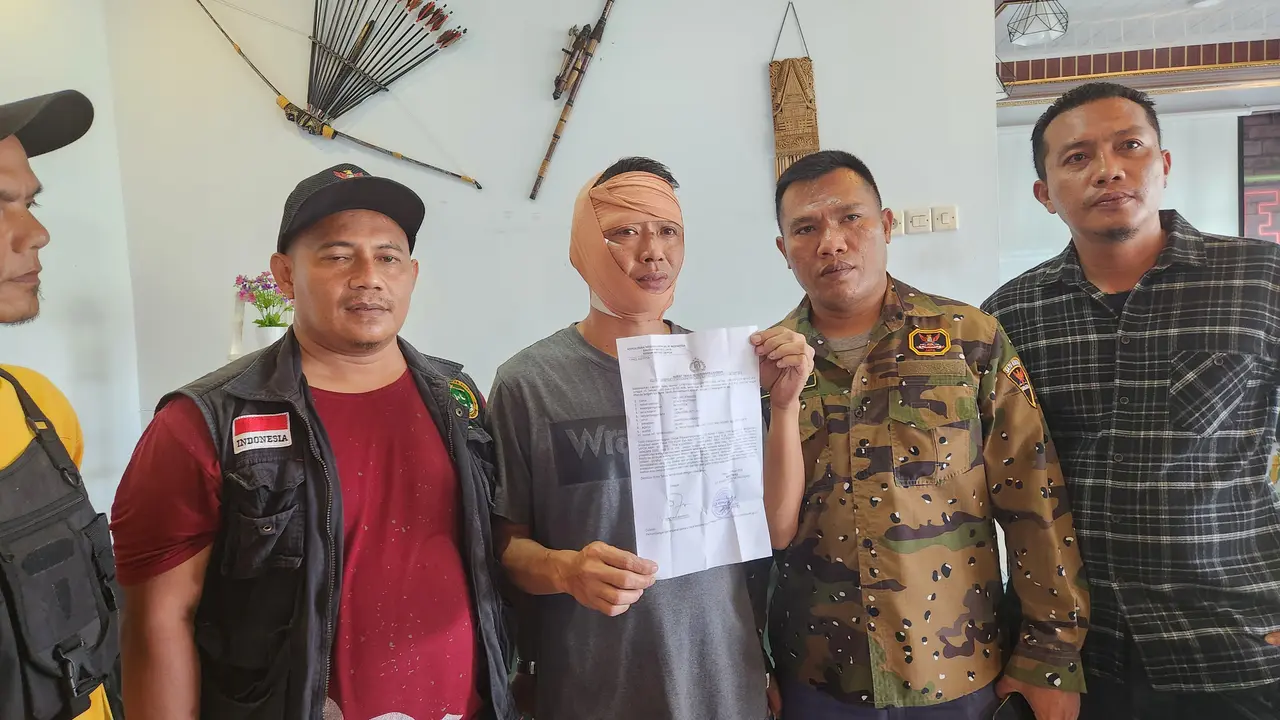Korban memperlihatkan laporan polisi usai mengalami penganiayaan diduga dilakukan oknum ormas di wilayah Depok. (Liputan6.com/Dicky Agung Prihanto)
