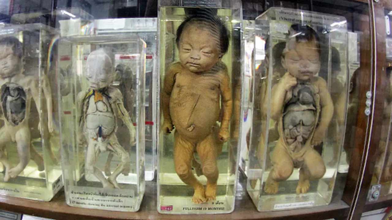 Barang Koleksi Museum 'Kematian' di Bangkok yang Bikin Ciut Nyali