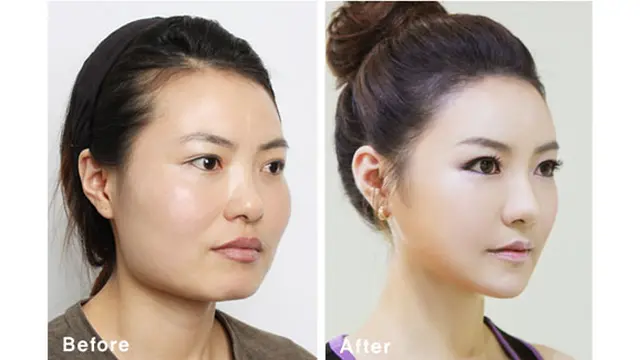 (c) kpsurgery tumblr.com