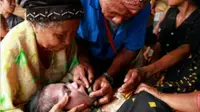 Ritual Unik Potong Gigi Wanita Sebelum Menikah di NTT. (Liputan6.com/Ola Keda)