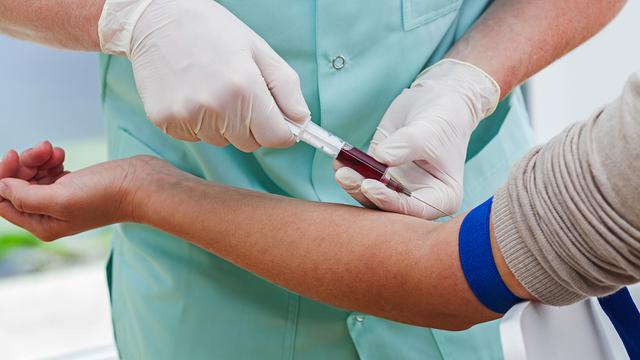 Tes Darah Kini Bisa Deteksi Penyakit Jantung Health Liputan6 Com