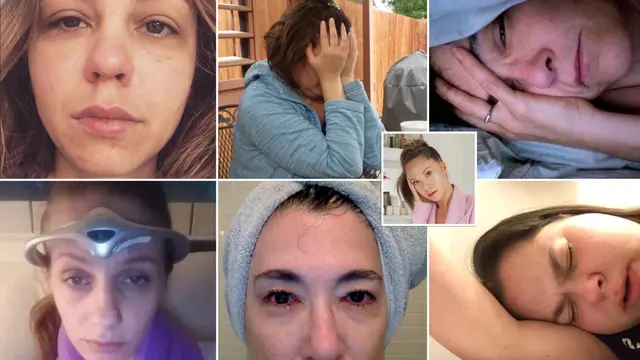 [Bintang] Digilai Para Selebriti Dunia, Pose Migrain Tuai Kecaman