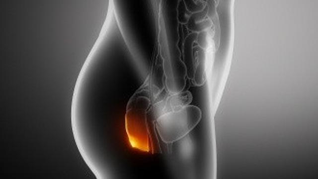 Wasir Diwaspadai atau Didiamkan?