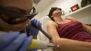 Jill Crenshaw menahan panas dan sakit ketika tato pada lengan kanannya dihapus menggunakan laser di klinik Dr. Tatoff, California, Rabu (11/5). Butuh beberapa kali dilaser agar tato tersebut benar-benar hilang. (AFP PHOTO/DAVID McNew) 