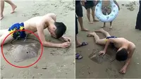 (Foto rangkuman dari Brilio.net) Saat asik berenang di laut pria asal Hainan, Tiongkok ini tersengat ekor ikan pari.