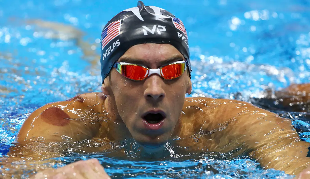 Tanda merah sebesar koin terlihat di pundak Michael Phelps, selama Olimpiade Rio 2016 di Rio de Janeiro, Minggu (7/8). Phelps memang satu dari sejumlah atlet di Olimpiade 2016 yang memilih terapi bekam untuk menjaga kebugarannya. (REUTERS/Michael Dalder)