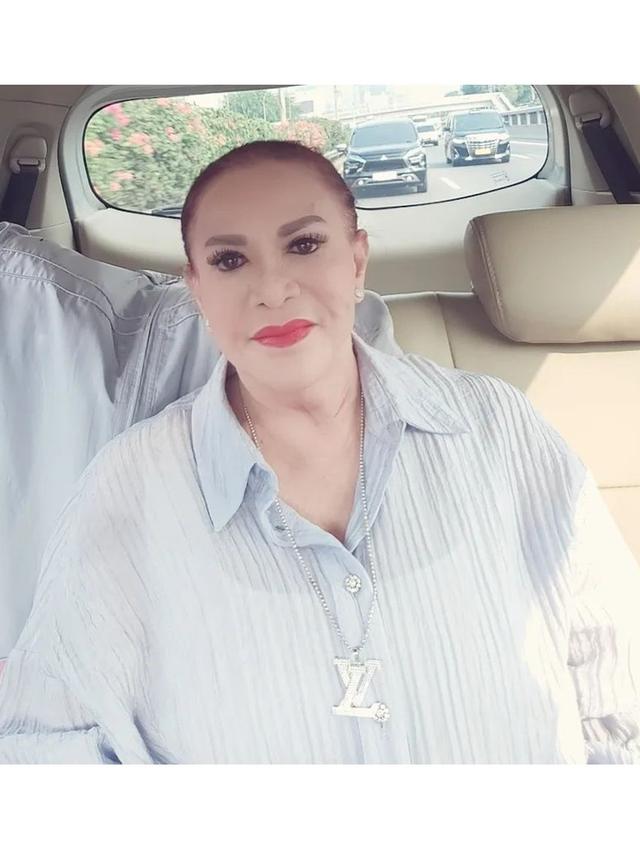 6 Potret Mpok Atiek yang Idap Polip di Ususnya, Akui Takut Ramalan Roy Kiyoshi