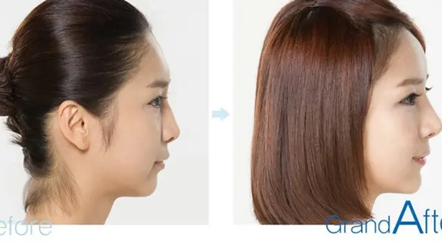 Foto: copyright koreaboo.com