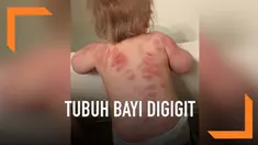 Seorang ibu asal Arizona, Amerika Serikat terkejut bukan main menemukan banyak bekas gigitan di tubuh buah hatinya. Bekas gigitan ditemukan usai bayinya yang berusia 15 bulan itu dititipkan di tempat penitipan anak.