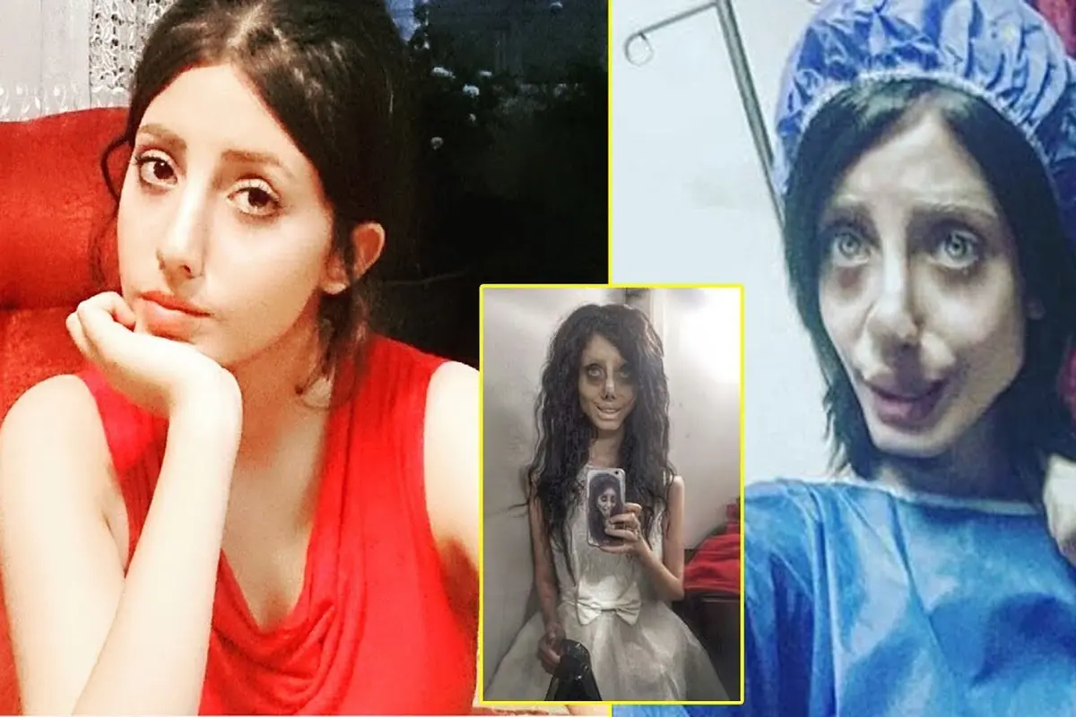 [Bintang] Terobsesi Sama Angelina Jolie, Wajah Sahar Tabar Berubah Drastis
