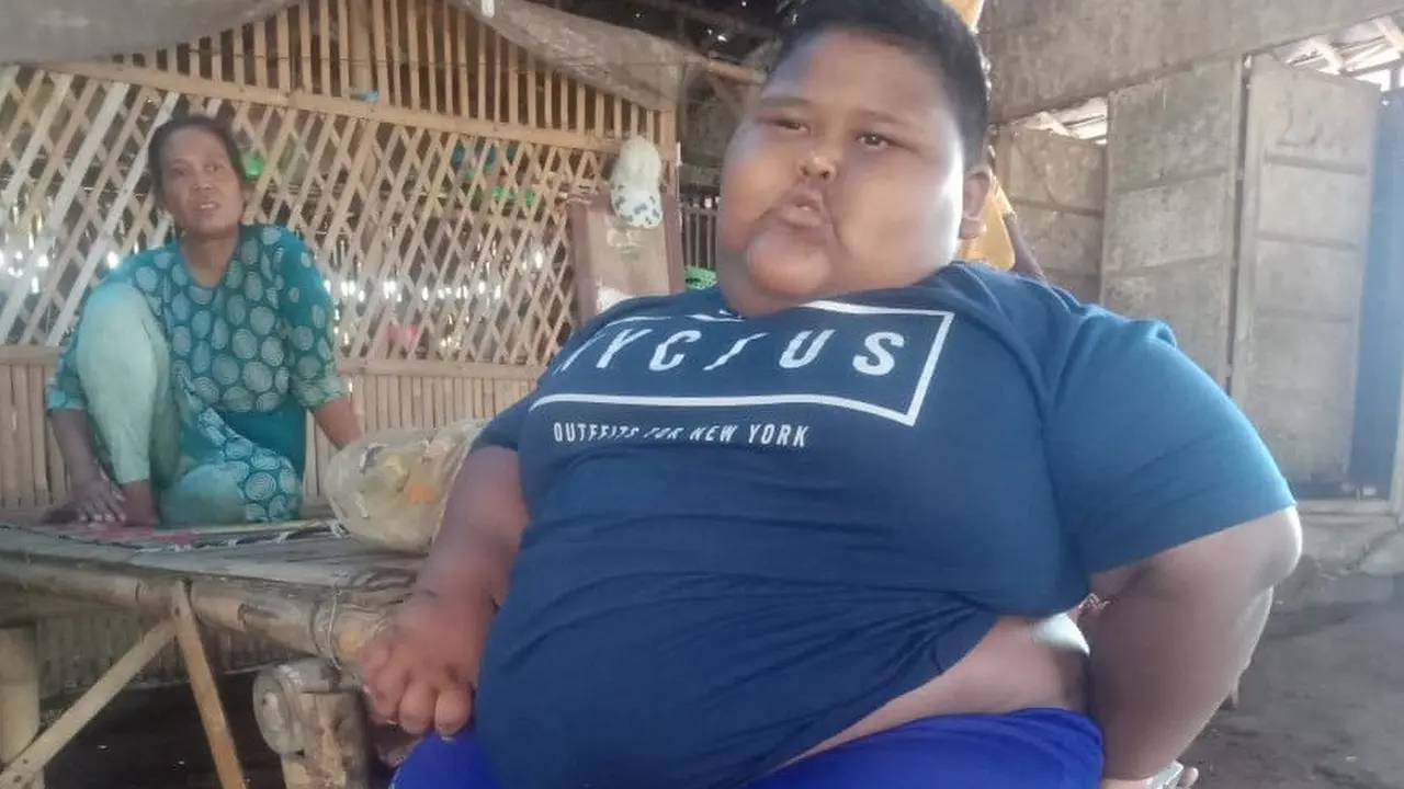 Satia Bocah Obesitas