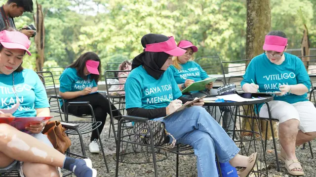 Surat Cinta dari Para Penderita Vitiligo untuk Sembuhkan Trauma Batin