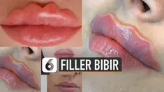 Tren baru dunia kecantikan yang kini sedang dibicarakan warganet. Filler bibir keriting sebenarnya pernah viral di 2017.