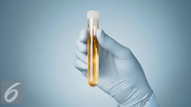 Ilustrasi Foto Air Seni atau Urine